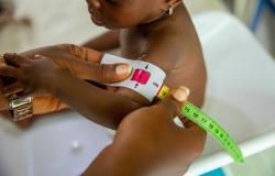 Overcoming global malnutrition requires debt justice Overcoming global malnutrition requires debt justice