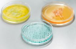 Antimicrobial Resistance as a Global Health Threat: The Need to Learn Lessons from the COVID-19 Pandemic Antimicrobial Resistance as a Global Health Threat: The Need to Learn Lessons from the COVID-19 Pandemic